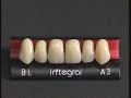 artegral imcrown | merz dental