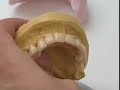 artegral imcrown | merz dental