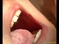 Corsi di Ortodonzia - \"Demo clinica dell\ Corsi di Ortodonzia - \"Demo clinica dell\