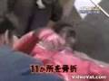 Amazing Bike Accident 2