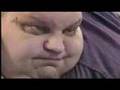 Obese man