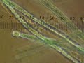 BIMM 121 Anabaena