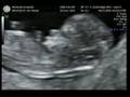 Baby Figueroa at 11 weeks