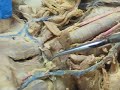 UHH Biol 243L Cat blood vessel anatomy part 1