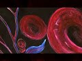 Silent Suffering September Is Sickle Cell Awareness Month