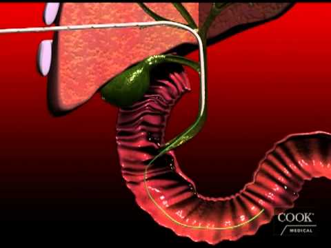 how to drain biliary drain