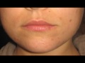 The Acne Practice  (Home Version 12)