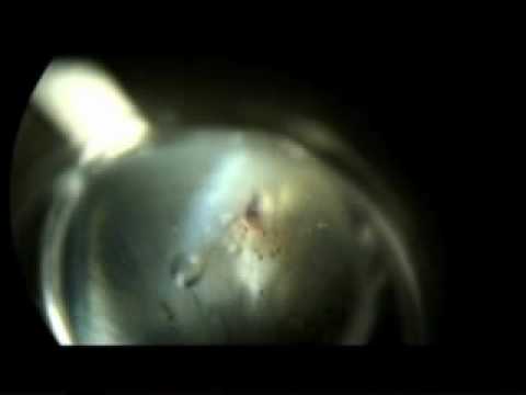 how to relieve glaucoma pressure in dogs
