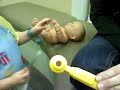 OMS - Visit to remove Neuroblastoma tumor.