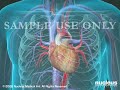 3D Medical Animation: Coronary Artery Angioplasty (Heart Stent)