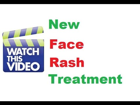 how to cure rashes on face fast