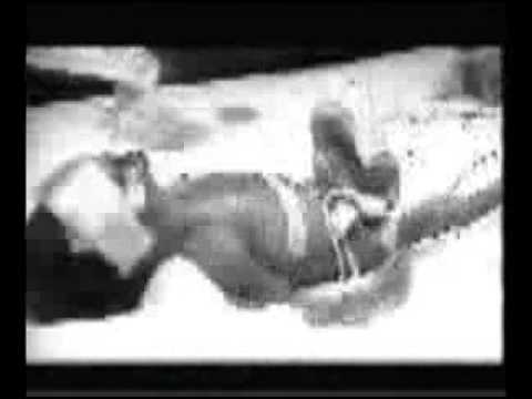 Fetal Alcohol Syndrome & Spectrum ...