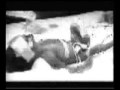 Fetal Alcohol Syndrome & Spectrum Disorders / FAS FASD Video
