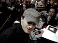 Daniel Radcliffe after Equus