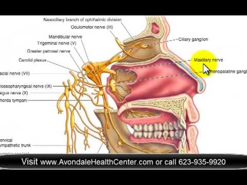 how to relieve cluster headaches
