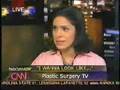 Manhattan Plastic Surgeon Dr Scot Glasberg on CNN Paula Zahn Show