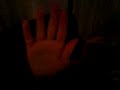 Mel qui mate la starac\