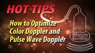 How to Optimize Color Doppler and Pulsed-Wave Doppler in Ultrasound