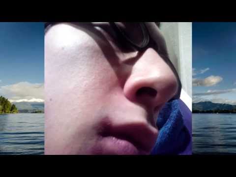 how to get rid of a cold sore in 24 hrs