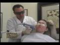treating acne scars