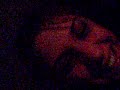 Snoring