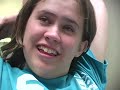 Tongue Thrust Therapy Tongue Thrust Therapy