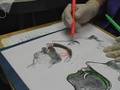 Tongue Thrust Therapy