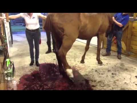how to treat hematoma after c section