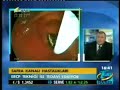 ERCP Her Ya?taki Hastaya Yap?labilir mi? ERCP Her Ya?taki Hastaya Yap?labilir mi?