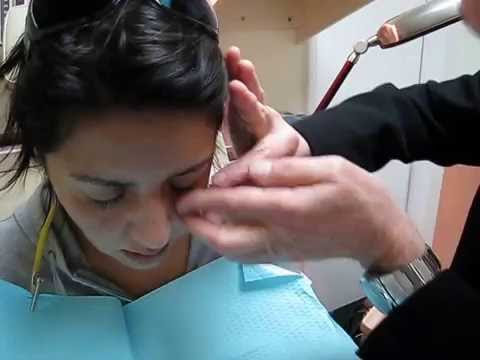 how to fit scleral lenses