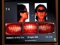 4 - Obiettivi di un trattamento tra i 7 e i 10 anni - (3/3)