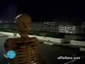 El Esqueleto Vivo El Esqueleto Vivo