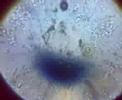 Trichodina