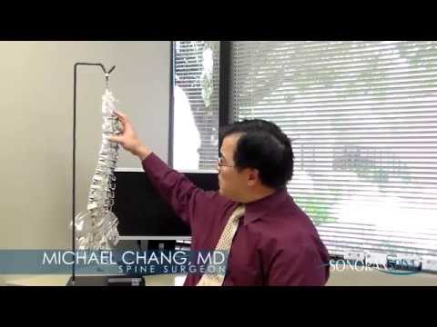 how to measure thoracic kyphosis