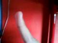eric's demanted finger