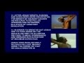 The Crucifixion of Jesus Evidence