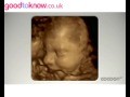 3D/4D baby scan - Anna's Pregnancy Diary: Week 28 video