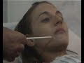 Si possono eseguire diversi tipi di PEELING a livello ambulatoriale, a seconda dalla profondità del derma in cui si agisce:    - peeling superficiale: interessa lo strato epidermico fino allo strato basale dell'epidermide.  E' prevalentemente indicato per acne, cicatrici da acne, esiti cicatriziali, iperpigmentazioni quali lentiggini solari e melasma, rughe superficiali delle guance e del contorno occhi    - peeling medio: interessa l'epidermide e parte del derma papillare. E' prevalentemente indicato per acne papulo-postulosa e nodulocistica, cicatrici da acne e da varicella, melasma, rughe di media profondità    - peeling profondo: interessa l'epidermide e il derma papillare fino al derma reticolare. E' prevalentemente indicato per rughe diffuse e più accentuate ed esiti cicatriziali. E' un peeling molto impegnativo