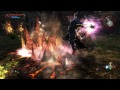 Click here to watch this video Let's Play Kingdoms of Amalur: Reckoning #019 [GERMAN/BLIND/HD] Nieder mit dem Nekromanten