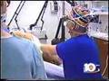 Top Plastic Surgeon Explains Smart Lipo Fat Removal