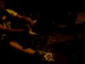 sprained-ankle-dance-1.html