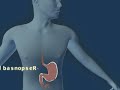 Helicobacter pylori Helicobacter pylori