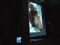 Cosmetic Surgery - PLASTIC SURGERY LECTURE: ASIAN FACE