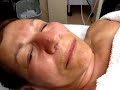 Terry Binns Cirepil Blue Lip Waxing Terry Binns Cirepil Blue Lip Waxing