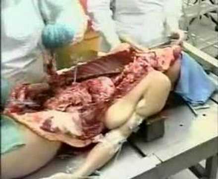 AUTOPSIA - una donna viene aperta in nome della scienza. con la telecronaca in inglese.