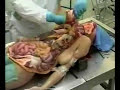 Autopsia di una donna - 01/02