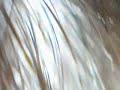must see moving morgellons disease organism must see