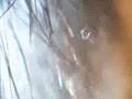 MUST SEE Moving Morgellons disease organism MUST SEE