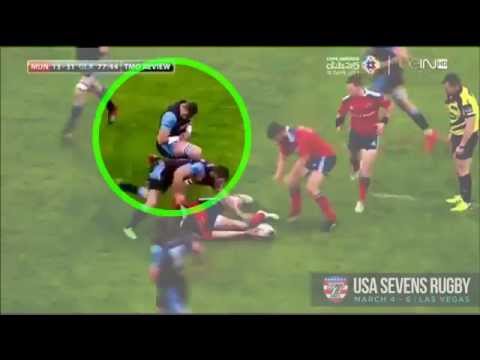 Rugby player calmly relocates his shoulder mid game