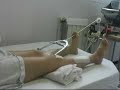 Polytraumatisme : kinésithérapie au lit du patient